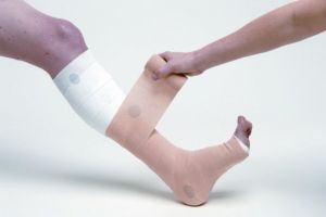 Як правильно бинтувати ноги при варикозі еластичним бинтом: фото, відео поради