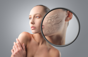 Суха шкіра обличчя   причини лущення, методи і правила боротьби, догляд