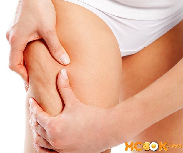 Целюліт (апельсинова кірка) причини виникнення і способи боротьби; профілактика Целюліт (апельсинова кірка) причини виникнення і способи боротьби; профілактика