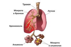 Туберкулема легень: операція