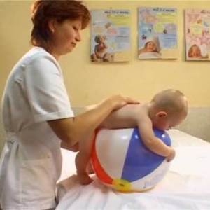 Симптоми і ознаки рахіту у немовлят, розглянемо фото захворювання. Як можна запобігти недуга?