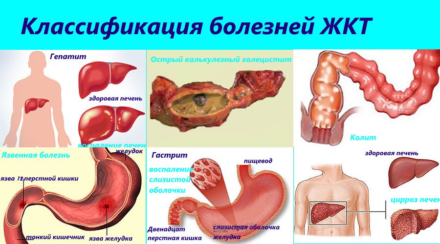 Як проявляються патології шлунково кишкового тракту