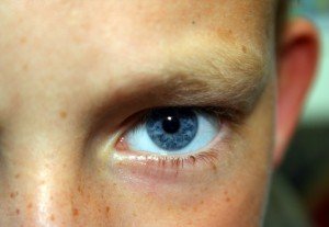 Червоні плями під очима у дорослих і дітей: причини, лікування