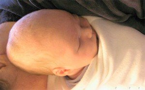 Чому у новонародженого на голові виникає кефалогематома? Як лікувати і чи потрібно втручання?