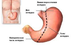 Операції на шлунку