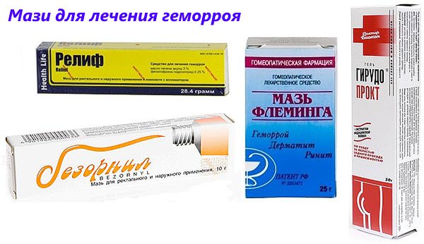 Чим характеризується поява зовнішнього геморою