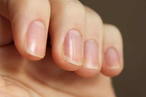 Лікування псоріазу нігтів: вибір ліки