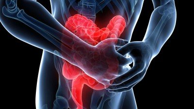 Виразковий коліт кишечника: симптоми, лікування, що це таке?