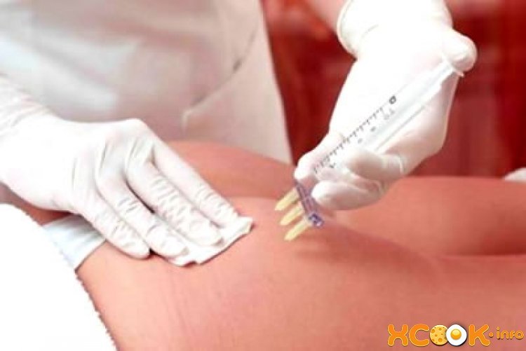 Процедури від целюліту в салонах як просто позбутися від апельсинової кірки? Процедури від целюліту в салонах як просто позбутися від апельсинової кірки?