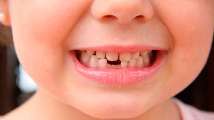 Прорізування зубів у дітей: послідовність, терміни, схема
