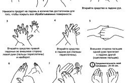 Обробка рук хірурга перед операцією