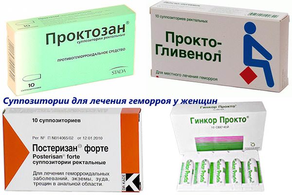 Як жінкам впоратися з гемороєм