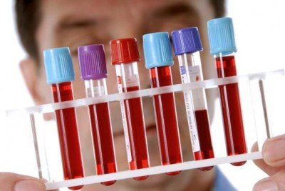 Біохімічний аналіз крові у дорослих, дітей: розшифровка таблиці норм показників