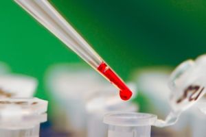 Генетична тромбофилия: фактори ризику, аналізи, маркери та лікування хвороби