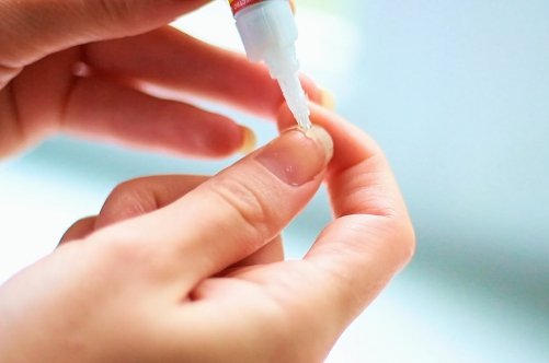 Зростання нігтів: як його прискорити за допомогою народних засобів?
