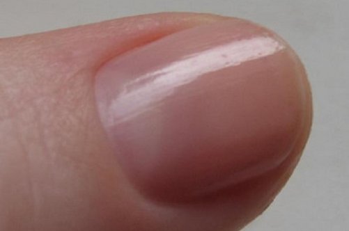 Чому нігті стають плоскими і як з цим боротися?