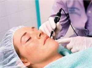 Лікування куперозу на обличчі – крок до краси і здоровю! Методи лікування хвороби