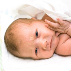 Симптоми і ознаки рахіту у немовлят, розглянемо фото захворювання. Як можна запобігти недуга?