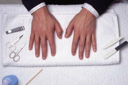Задирки на пальцях у чоловіків: чим краще видалити?