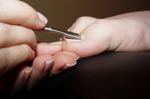 Грибок на нігтях ніг: чим його лікувати?