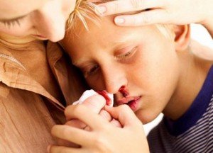 Педіатри про те, чому у дитини йде кров з носа. Як зупинити кров?