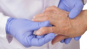 Як визначити артрит пальців рук, чим він небезпечний, методи його профілактики та лікування