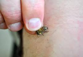 Апітерапія — лікуємо варикоз і інші захворювання за допомогою бджіл