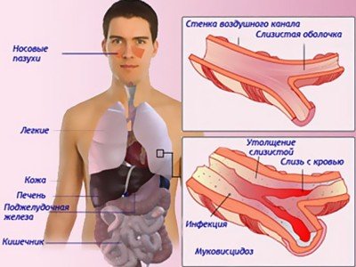 Пронос, діарея у дитини 2, 3, 4, 5 років: чим лікувати, що робити