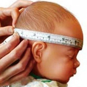 Гідроцефалія головного мозку у новонароджених   методи лікування і чим загрожує для малюка?