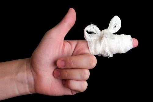 Що робити при ударі нігтя, якщо ніготь злазить?