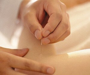Фізична активність як спосіб боротьби з гемороєм