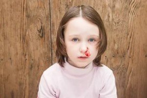 Кров з носа у дитини: причини і методи лікування