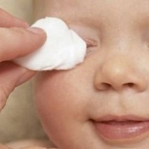 Що робити, якщо у дитини гнояться очі? Чим потрібно лікувати недугу?