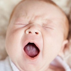 Причини появи білого нальоту на язиці у немовляти. Методи лікування хвороби.