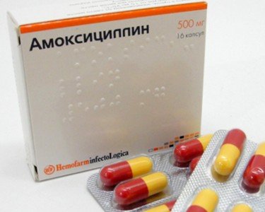 Лікування виразки шлунка: медикаментами, таблетками, ліками, препаратами