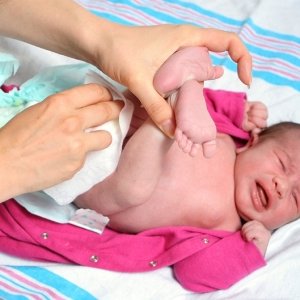 Пронос у новонародженого при грудному вигодовуванні   як лікувати недугу народними і медикаментозними способами?