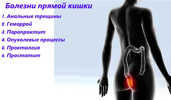 З яких причин зявляються різкі болі внизу живота