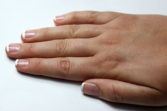 Як перестати гризти нігті | Як перестати гризти нігті дітям Як перестати гризти нігті | Як перестати гризти нігті дітям