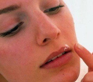 Герпес на губах під час вагітності   лікування необхідно, чим небезпечний в 1 2 3 триместе?