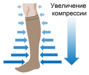 Компресійний трикотаж при варикозі