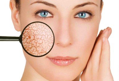 Лущитися шкіра на обличчі з почервонінням: лікування свербежу