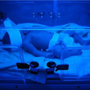 Лікування жовтяниці у новонароджених в домашніх умовах за допомогою народної медицини. Як боротися з недугою лампою?