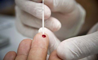 Ротавірусна інфекція у дорослих: симптоми, причини, лікування