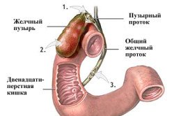 Дієта після видалення жовчних каменів