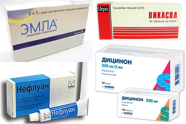 Як перемогти геморой в домашніх умовах?