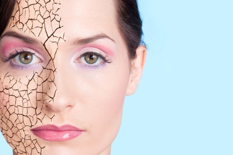 Як боротися з сухістю шкіри: корисні поради по догляду за шкірою