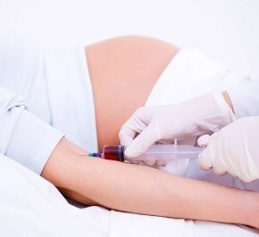 Коагулограма при вагітності   розшифровка та норма, для чого потрібен аналіз?