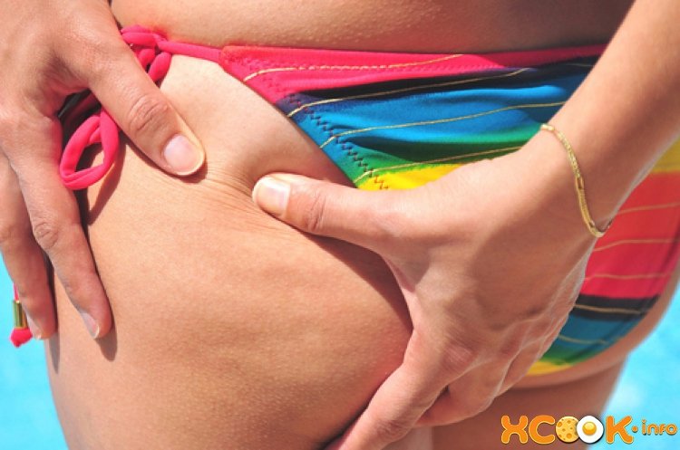 Целюліт (апельсинова кірка) причини виникнення і способи боротьби; профілактика Целюліт (апельсинова кірка) причини виникнення і способи боротьби; профілактика