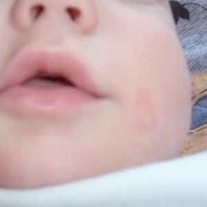 Як визначити хворобу по червоних плям на тілі дитини? У яких випадках варто звернутися до лікаря?
