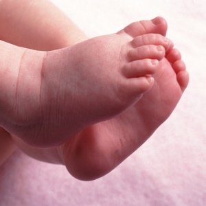 Варто хвилюватися, якщо у дитини облазить шкіра на пальцях рук і ніг? Профілактика захворювання.
